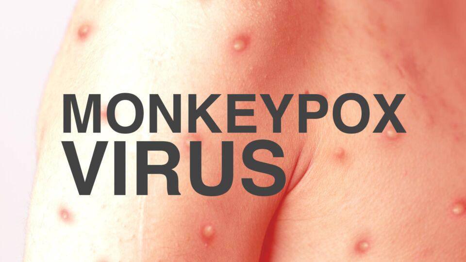 Bệnh đậu mùa khỉ khi mang thai: Dấu hiệu, triệu chứng
