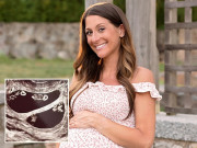 Bà bầu - Mẹ sinh cùng lúc 2 cặp song thai, bác sĩ tấm tắc 70 triệu ca mới có một