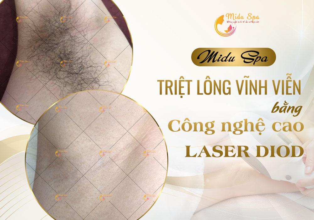 Midu Spa là trung tâm chuyên triệt lông hiệu quả tại TP.HCM
