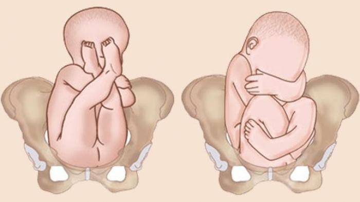 Thai nhi tháng cuối thường nằm 4 kiểu này, nếu là dáng đầu tiên mẹ thở phào nhẹ nhõm - 5