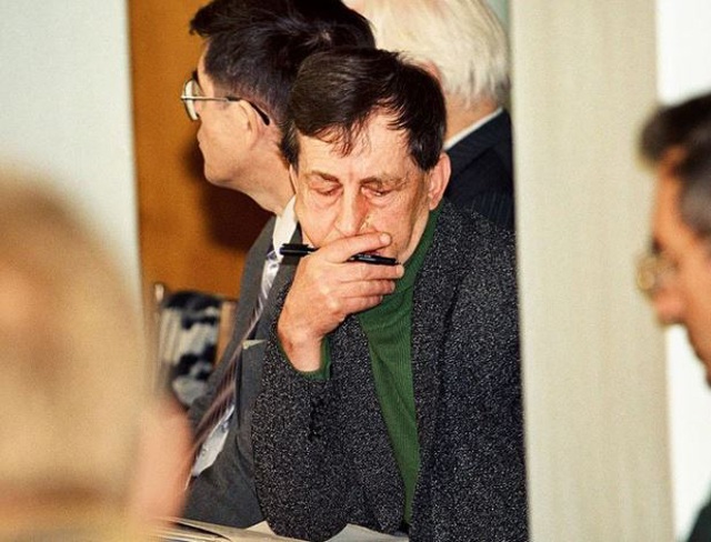 Người đàn ông sở hữu amp;#34;khuôn mặt âm dươngamp;#34;, một nửa mặt già đi, nửa còn lại vẫn trẻ măng - 3