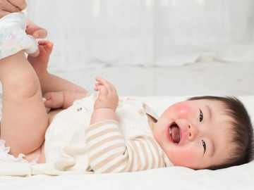 Nguyên nhân trẻ sơ sinh bị hăm đỏ hậu môn
