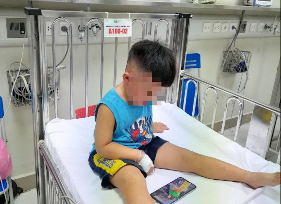 Cháu bé hiện đang được điều trị tại BV Nhi Trung ương. Ảnh: BVCC.