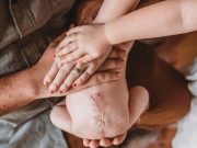 Bà bầu - Em bé chào đời với vết sẹo chằng chịt trên lưng, bố mẹ ôm nhau khóc cảm ơn bác sĩ