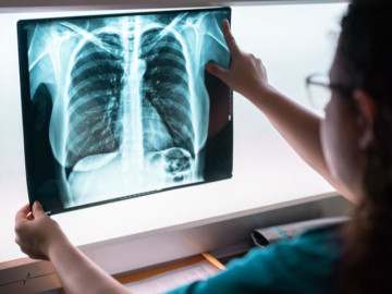 Chồng mắc ung thư, vợ đi khám nhận hung tin, cảnh báo việc đàn ông hay làm dễ “đầu độc” cả nhà