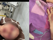 Tin tức - Em gái nạn nhân bị đánh do song ca ở quán karaoke: Nhìn thấy chị, tôi rất sốc và hoảng sợ