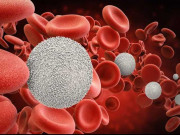 Ung thư máu: Phương pháp kiểm soát tác dụng phụ hóa trị và nâng cao thể trạng