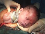 Bà bầu - Không muốn con trong bụng bị nhau quấn cổ, mẹ bầu phải hạn chế 4 hành động này!