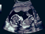 Tin tức - Suốt ngày bị chồng mắng chửi vì hiếm muộn, vợ bàng hoàng khi kiểm tra cái thai trong bụng