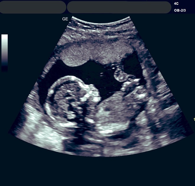 Người a classTextlinkBaiviet hrefhttps://eva.vn/phụ nữ/a phát hiện mang thai con của tình nhân