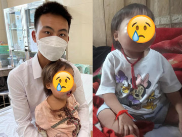Em bé vùng cao gương mặt sưng vù vì ung thư đã qua đời: “Tạm biệt nhân gian đầy đau đớn để lên thiên...