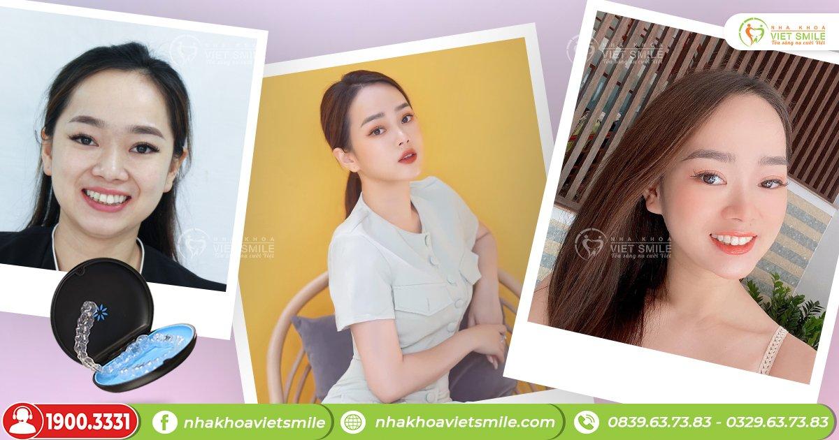 Vật liệu nha khoa tại phòng khám đều đảm bảo về mặt chất lượng