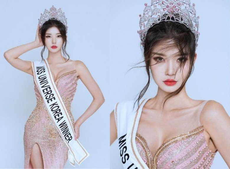 Xuất hiện đối thủ mạnh của Ngọc Châu tại Miss Universe, cao 1m83 da trắng dáng chuẩn là chân dài quốc tế - 1