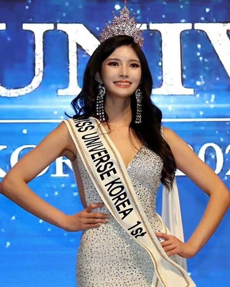 Xuất hiện đối thủ mạnh của Ngọc Châu tại Miss Universe, cao 1m83 da trắng dáng chuẩn là chân dài quốc tế - 3