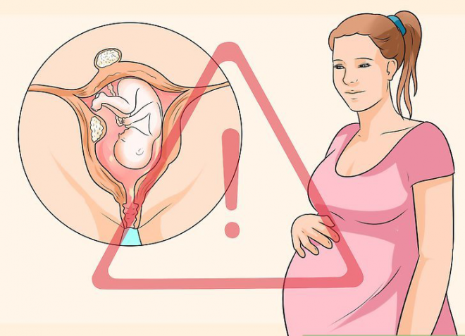 Quảng Nam: Bác sĩ bóc khối u xơ amp;#34;khủngamp;#34; chặn lối ra của thai nhi, cứu em bé chào đời an toàn - 2