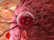 Sức khỏe - Viện sĩ 93 tuổi có hơn 60 năm nghiên cứu về ung thư khuyên tránh xa 4 điều để sống khỏe, ngừa ung thư