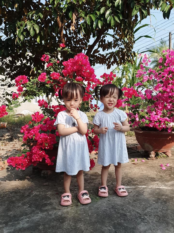 Hình ảnh bất ngờ của cặp đôi song sinh dính liền Diệu Nhi - Trúc Nhi sau 2 năm phẫu thuật tách rời - 1