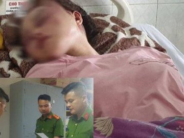 NÓNG: Bắt cán bộ QLTT đánh bạn gái dã man vì hát song ca với người khác