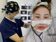 Làm đẹp - Lựa chọn bác sĩ phẫu thuật thẩm mỹ đúng chuyên ngành hạn chế rủi ro biến chứng