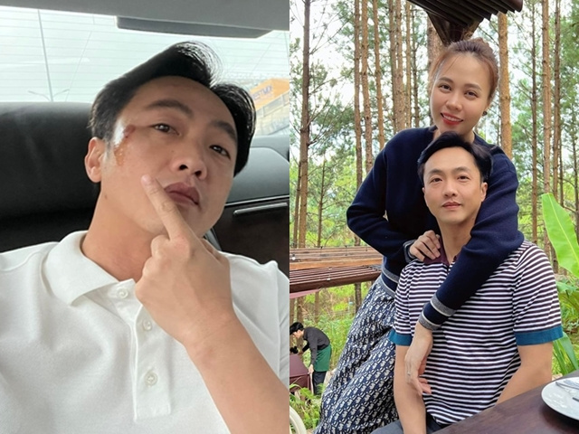 Cường Đô La đăng ảnh mặt bị thương, Đàm Thu Trang không thèm đoái hoài, dân mạng đoán vợ đánh