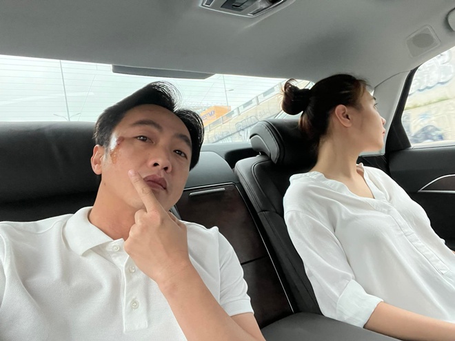 Cường Đô La đăng ảnh mặt bị thương, Đàm Thu Trang không thèm đoái hoài, CĐM bán tán rôm rả - 1