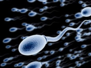 Sức khỏe - Tinh trùng khỏe mạnh có màu gì? Tinh dịch màu gì thì đáng lo?