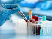 Tin tức - Vợ đòi sinh một con nhưng lại đột nhiên mang thai đứa thứ 2, chồng bàng hoàng khi xét nghiệm ADN