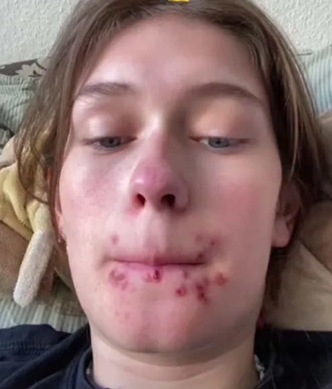 Cô gái trẻ đã có một nụ hôn suốt đời không quên.