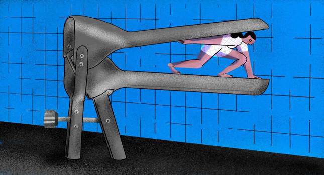 Người phụ nữ trong gọng kìm của bác sĩ phụ khoa, hình ảnh hài hước trên báo Mỹ.