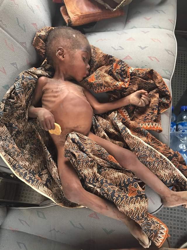 Hình ảnh đẹp trai bụ bẫm của cậu bé châu Phi suy dinh dưỡng từng làm thế giới xót xa - 2
