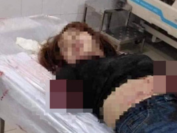 Lời khai ban đầu của người chồng chém lìa 2 cánh tay vợ