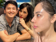 Làm đẹp - Bị nói thẩm mỹ như ma-nơ-canh, bạn gái hơn 6 tuổi của Huỳnh Anh treo thưởng 2000$ tìm bằng chứng