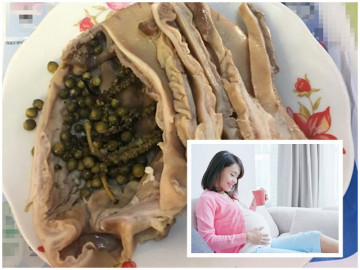 Thực hư chuyện mẹ bầu ăn dạ dày lợn hấp tiêu ở tuần thai 32-33, con sinh ra không tiêu chảy bao giờ?