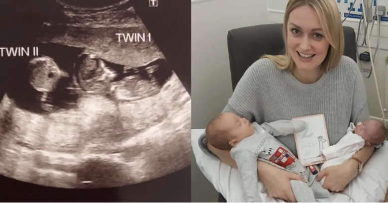 Đang mang thai 3 tháng, mẹ bầu đi siêu âm tá hỏa biết có thêm 1 bé nữa trong tử cung - 4