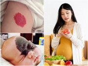 Bà bầu - Mẹ bầu “cố chấp” ăn 2 thực phẩm này, đừng hỏi sao sinh con ra có bớt chàm xanh đỏ