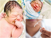 Bà bầu - Bé trai chào đời cầm theo cả vòng tránh thai của mẹ: Cách xử trí khi đặt vòng mà vẫn có thai?