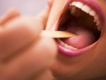 Nghiện rượu bia, thanh niên 26 tuổi mắc bệnh ở lưỡi rồi tử vong