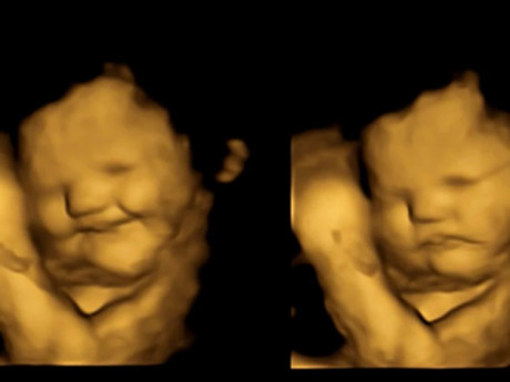 Bất ngờ thai nhi biết phản ứng với thức ăn từ trong bụng mẹ: Nhăn mặt khi ăn cải xoăn, cười tươi khi ăn cà rốt