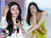 Làm đẹp - Chân dài đắt giá đẹp như tiên vẫn mê "dao kéo", giờ mặt sưng phù biến dạng, fans ruột nhận không ra