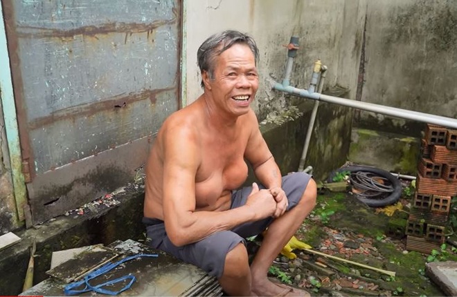 Người đàn ông Bình Dương sở hữu vòng 1 amp;#34;siêu khủngamp;#34;, nguyên nhân đến giờ vẫn chưa thể lý giải nổi - 1