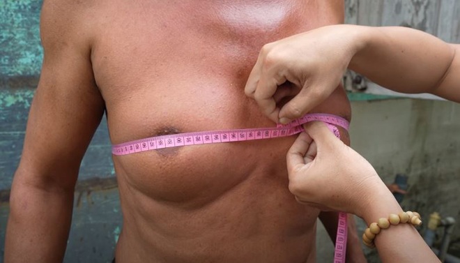 Người đàn ông Bình Dương sở hữu vòng 1 amp;#34;siêu khủngamp;#34;, nguyên nhân đến giờ vẫn chưa thể lý giải nổi - 4