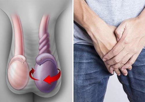 Tinh hoàn bị teo cả hai bên rất nguy hiểm, ảnh hưởng lớn đến sinh lý, sinh sản của nam giới. (Ảnh minh họa)