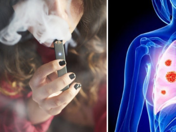 Thiếu nữ 14 tuổi hôn mê sau điếu thuốc lá điện tử, cảnh báo nhiều học sinh ngộ độc vì loại thuốc tưởng vô hại