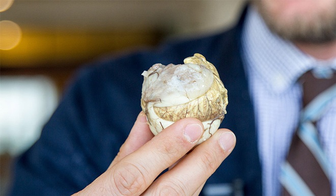 V&igrave; sao trứng vịt lộn ăn buổi s&aacute;ng l&agrave; thuốc bổ nhưng tối lại rất hại? Đặc biệt trẻ độ tuổi n&agrave;y muốn ăn cũng kh&ocirc;ng n&ecirc;n - 3