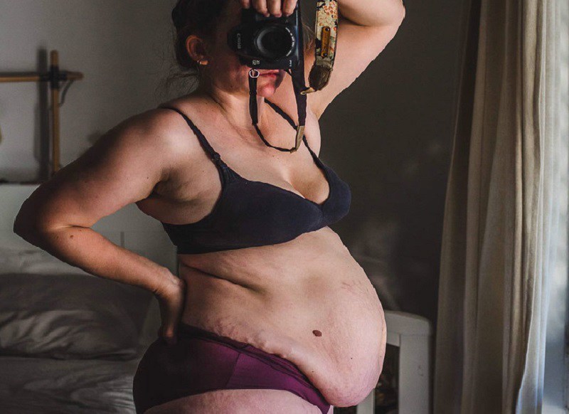 Bà mẹ chia sẻ hình ảnh cơ thể mình 2 tháng sau sinh. Quá trình mang thai đối với cô là 1 chuỗi sự ngạc nhiên khi lần đầu thấy vết rạn da, rồi số cân nặng cứ tăng và tăng mãi lên đến hơn 100kg và chiếc bụng không nhỏ lại sau khi em bé chào đời. 
