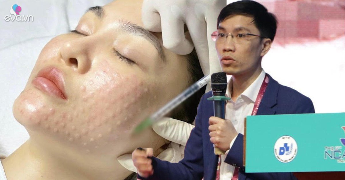 View - Làm đẹp kiểu mì ăn liền với phương pháp tiêm Meso, cẩn thận với các chuyên gia bắt chước nửa vời