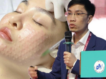 Làm đẹp kiểu mì ăn liền với phương pháp tiêm Meso, cẩn thận với các chuyên gia bắt chước nửa vời