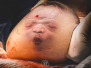 Bà bầu - Nhiếp ảnh gia bắt trọn những khoảnh khắc ấn tượng khi em bé vừa ra khỏi bụng mẹ