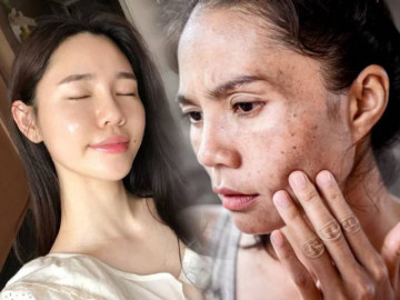 Không phải chống nắng, các chuyên gia cho biết hầu hết người có làn da nhẵn thín đều chung thói quen này