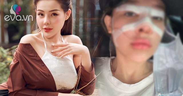 View - Ngân 98 giữ kỷ lục đệ nhất dao kéo, nhan sắc ra sao mà vẫn bị gièm pha càng sửa càng xấu